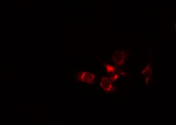 Polyclonal Rabbit anti-Human MYOM2 / Myomesin 2 Antibody (IF, WB)