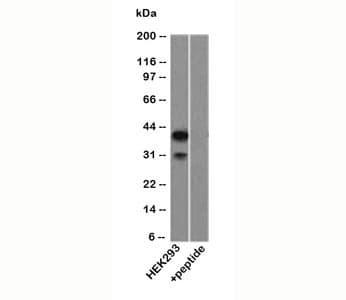 TP63 / p63 Antibody (aa5-17)