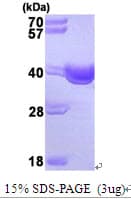 Human SGTA / SGT Protein (Recombinant His)