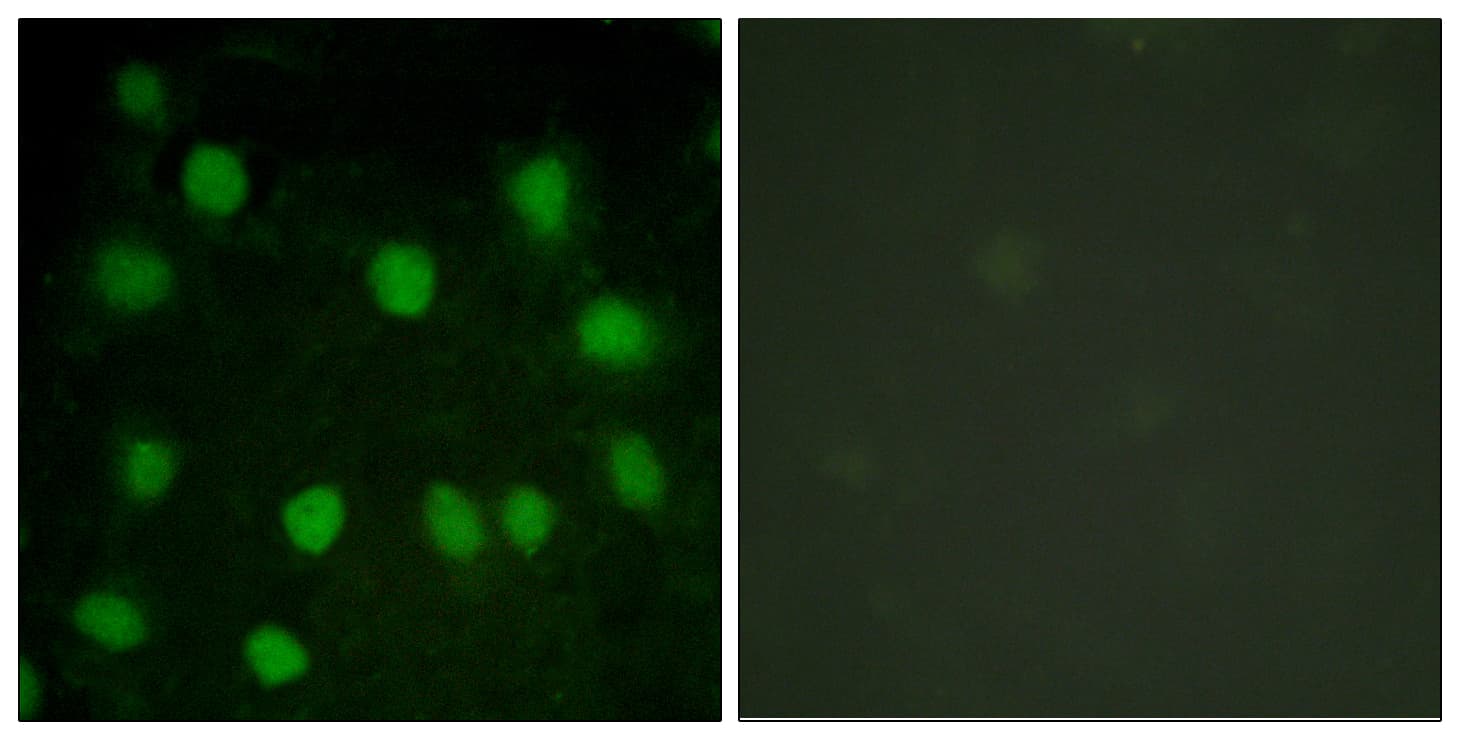 Polyclonal Rabbit anti-Human DMTN / Dematin Antibody (aa356-405, IHC, IF, WB)