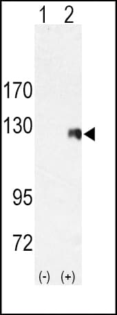 ROR2 Antibody (aa915-943)