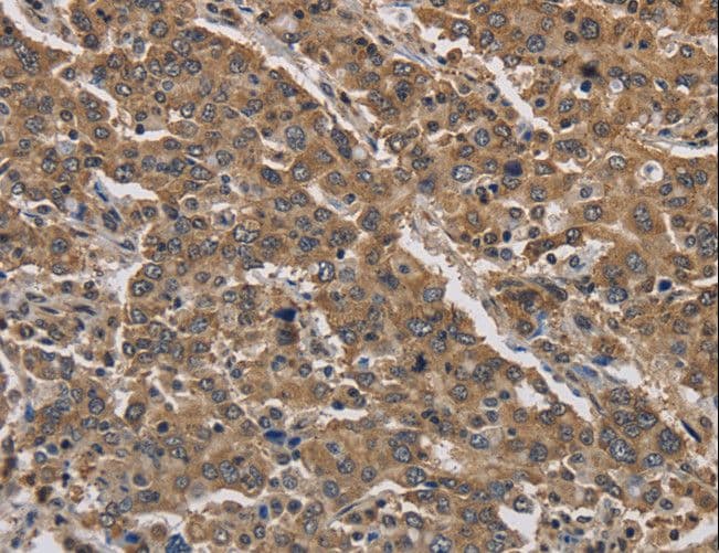 JAG2 / Jagged-2 Antibody