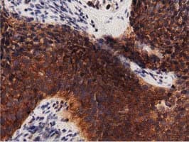 PRKD2 / PKD2 Antibody (clone OTI5G1)