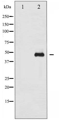 Polyclonal Rabbit anti-Human GATA1 Antibody (phospho-Ser310, WB)