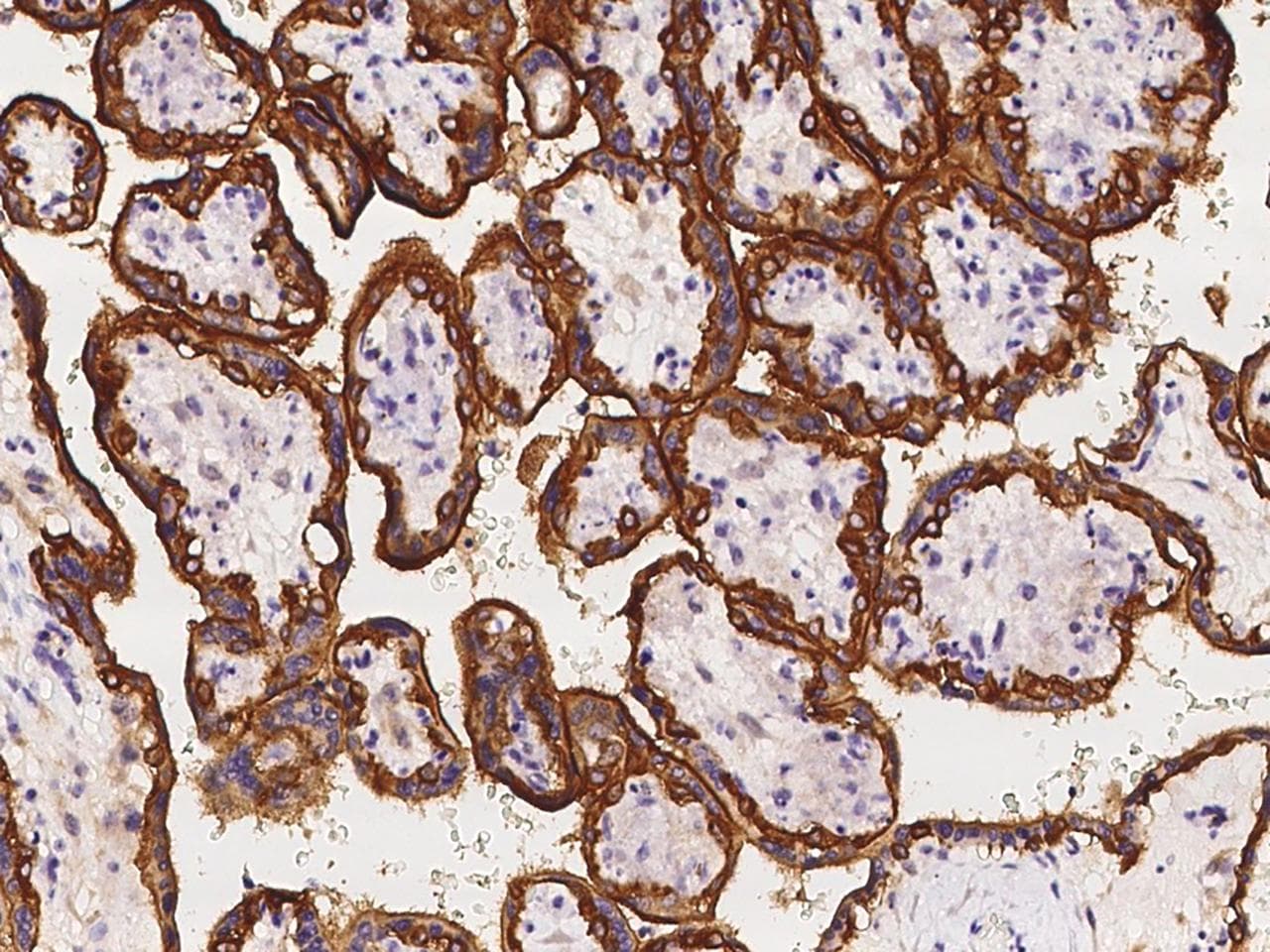 Polyclonal Rabbit anti-Human EGFR Antibody (IHC)