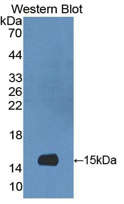 S100A9 / MRP14 Antibody (aa12-89, Cy3)
