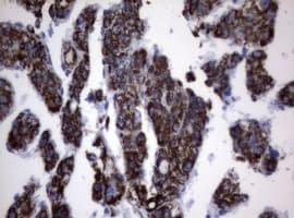 Monoclonal Mouse anti-Human PIK3CD / PI3K Delta Antibody (clone OTI1B5, aa286-610, IHC, WB)