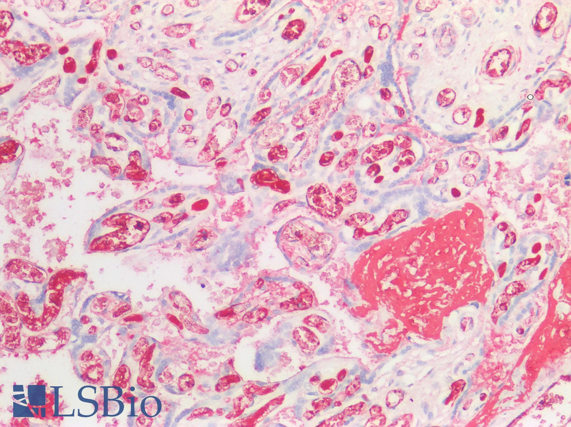 PathPlus™ FGA / Fibrinogen Alpha Antibody