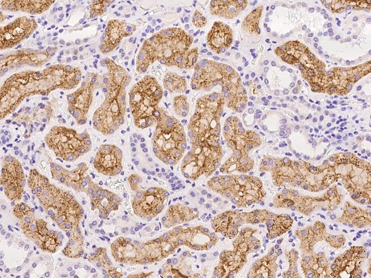 Polyclonal Rabbit anti-Human ENPEP / Aminopeptidase A Antibody (IHC, IF)