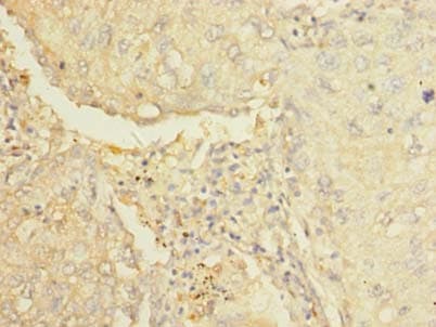 Polyclonal Rabbit anti-Human AARSD1 Antibody (IHC, WB)
