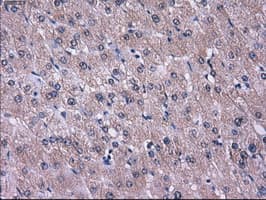 Monoclonal Mouse anti-Human L1CAM Antibody (clone OTI2C7, IHC, IF, WB)