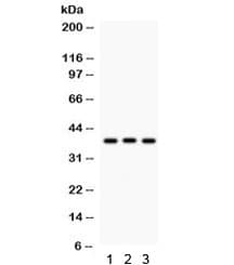 Polyclonal Rabbit anti-Human CTGF Antibody (IHC, WB)