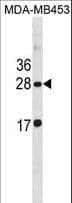 Polyclonal Rabbit anti-Human CLDN14 / Claudin 14 Antibody (aa172-200, WB)