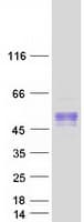 Human BTBD17 Protein (Recombinant Myc-DDK (Flag))