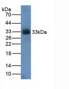 CDK4 Antibody (aa6-295, Biotin)