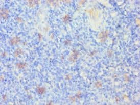 KRT14 / CK14 / Cytokeratin 14 Antibody (aa1-472)