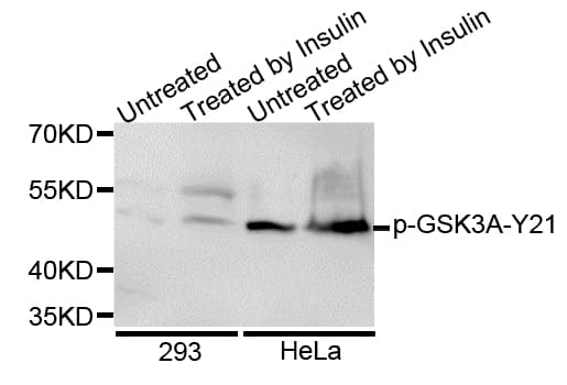 GSK3A / GSK3 Alpha Antibody (phospho-Ser21)