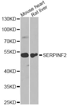 SERPINF2 / Alpha-2-Antiplasmin Antibody