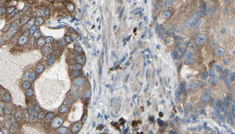 KRT23 / Keratin 23 Antibody