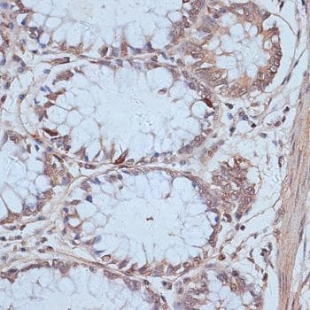 SNW1 / SKIP Antibody