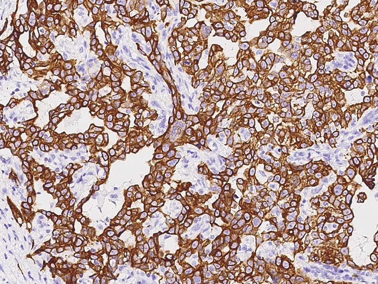 Polyclonal Rabbit anti-Human KRT18 / CK18 / Cytokeratin 18 Antibody (Preservative Free, IHC, WB)