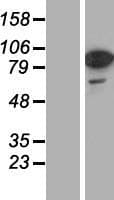 RAB11FIP1 Protein (Over-Expression Lysate Myc-DDK (Flag))