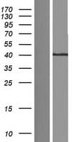Human SGOL1 / Shugoshin Protein (Over-Expression Lysate Myc-DDK (Flag))