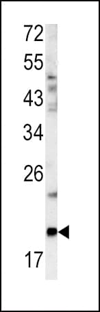PathPlus™ GCG / Glucagon Antibody (aa25-54)