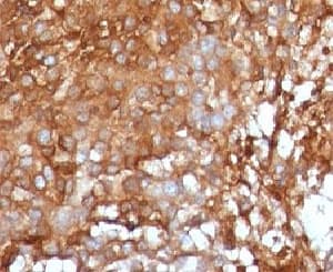 B2M / Beta 2 Microglobulin Antibody (clone B2M/961, Ready-to-Use)