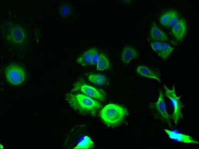 TMCO5A Antibody (Coiled-coil domain)