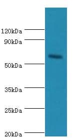 Polyclonal Rabbit anti-Human CRY2 Antibody (aa434-593, IHC, WB)