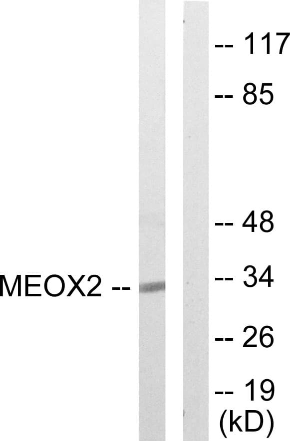 GAX / MEOX2 Antibody (aa151-200)