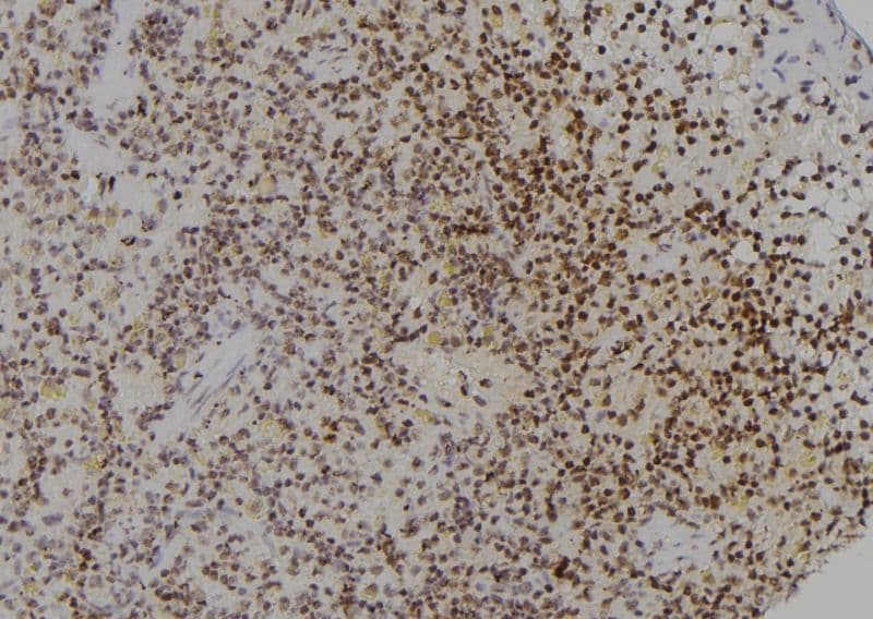 HNRNP-E2 / PCBP2 Antibody