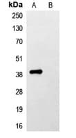 Flag Tag Antibody