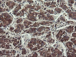 UBE2J1 Antibody (clone OTI3D1)