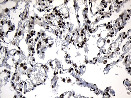 ZNF583 Antibody (clone OTI4H2)