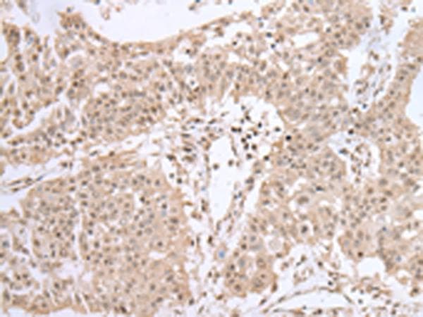 UBE2I / UBC9 Antibody