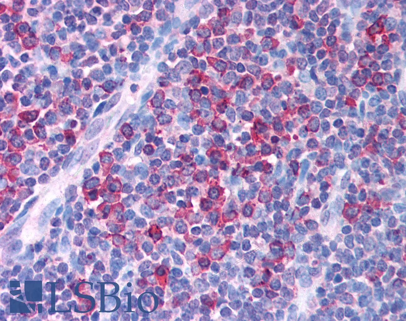 AML1 / RUNX1 Antibody (N-Terminus)