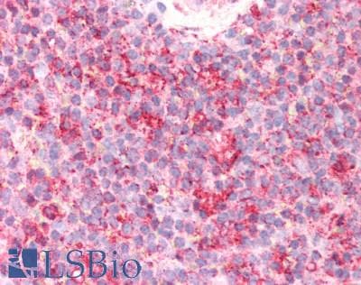 Polyclonal Rabbit anti-Human GBA / Glucosidase Beta Acid Antibody (aa334-498, IHC, WB)