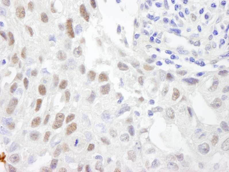 Polyclonal Rabbit anti-Human ZHX3 Antibody (aa150-200, IHC, IF)