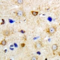 GRPEL2 Antibody