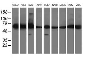DPH2 Antibody (clone OTI4E7)