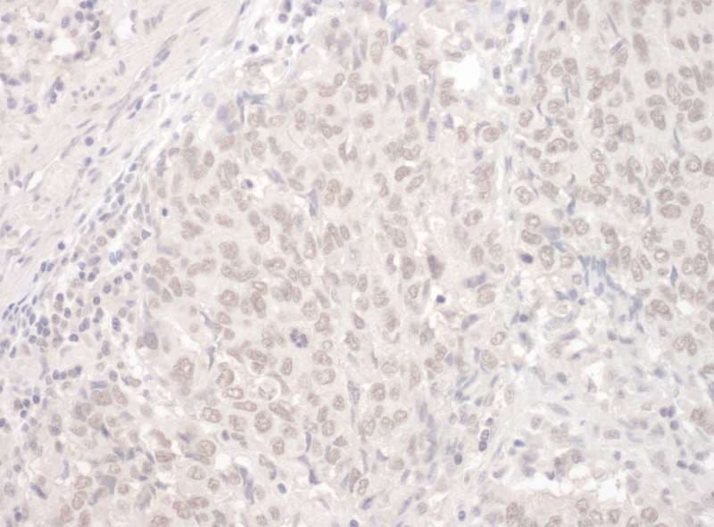 Polyclonal Rabbit anti-Human PUF60 Antibody (aa1-50, IHC, WB)