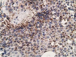 Monoclonal Mouse anti-Human SSX1 Antibody (clone OTI2F8, IHC, IF, WB)