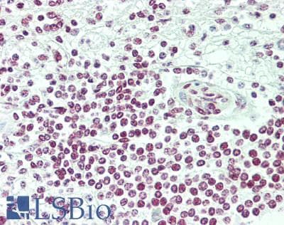 IHC-plus™ Polyclonal Rabbit anti-Human BRD2 / RING3 Antibody (aa675-725, IHC, IF, WB)