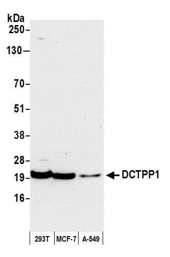 DCTPP1 / XTP3TPA Antibody (aa120-170)
