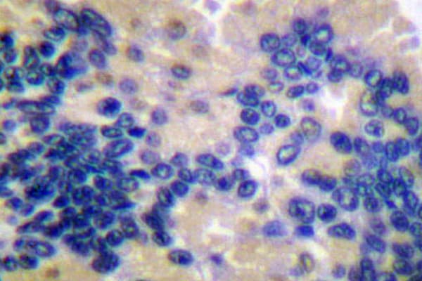 Polyclonal Rabbit anti-Human CASP10 / Caspase 10 Antibody (Lys442, IHC, IF, WB)