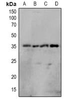 OTUB1 / OTU1 Antibody