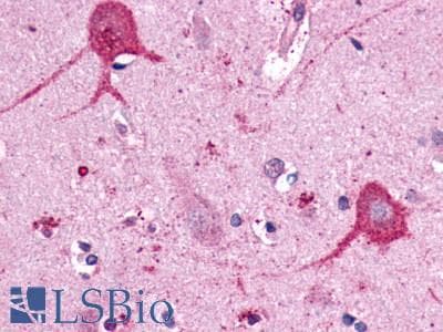 PathPlus™ Encephalopsin / OPN3 Antibody (C-Terminus)