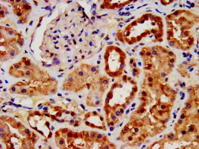 Polyclonal Rabbit anti-Human AIFM1 / AIF / PDCD8 Antibody (aa103-612)